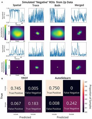 Automated Curation of CNMF-E-Extracted ROI Spatial Footprints and Calcium Traces Using Open-Source AutoML Tools